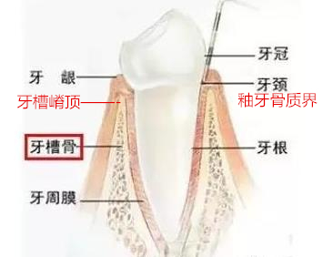 呂長勝 整牙的并發(fā)癥和預(yù)防（附照）1.jpg